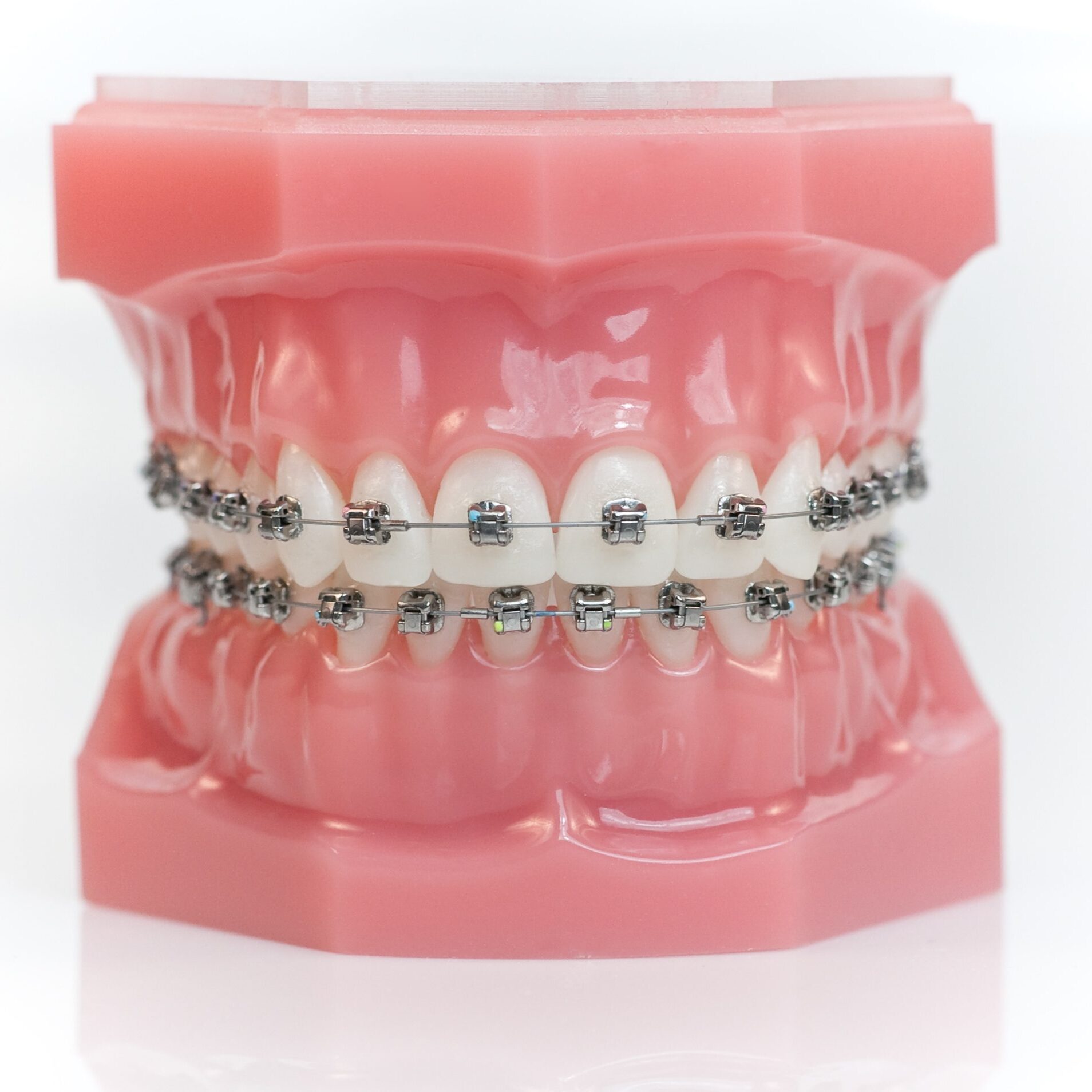 dentist linden nj